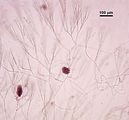 2 - Carposporofiti